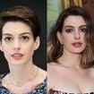 Anne Hathaway antes e depois: da juventude ao suposto lifting facial, 50 fotos mostram transformação impactante da atriz em 26 anos